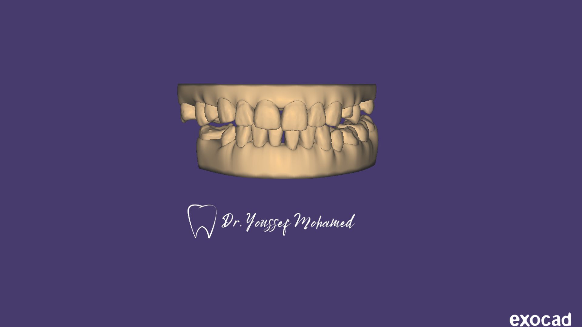 Profile of Exomaster - CadCam Masters