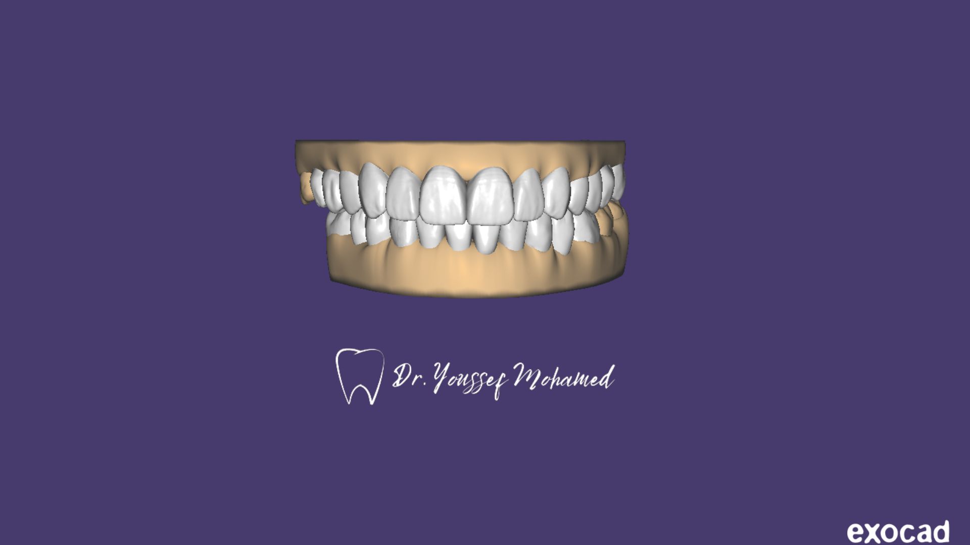 Profile of Exomaster - CadCam Masters