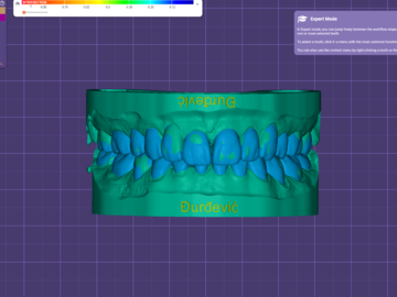 Dental Cad Service: digital waxup