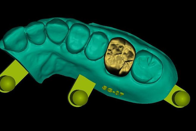Modelos - CadCam Masters