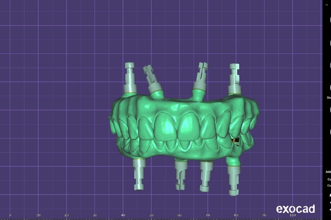 100 - CadCam Masters