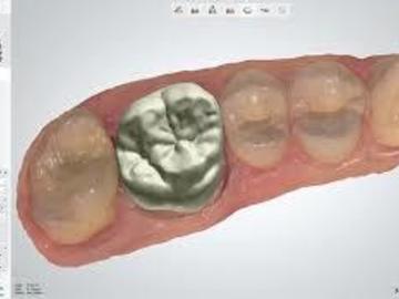 Dental Cad-Service: Single unit Crown & Bridge