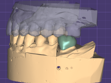 Dental Cad-Service: High-Quality Dental CAD Design | Fast Turnaround & Precision Work