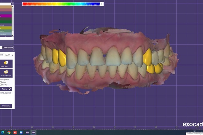 3D Dental CAD Design in Exocad for Labs & Clinics