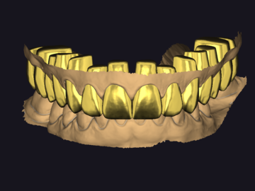 Dental Cad-Service: Wax-up (Unities)