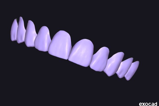 Veneers (Unities)