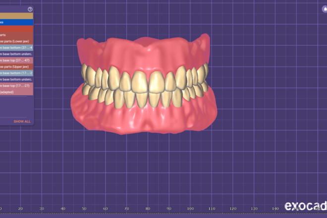 complete denture