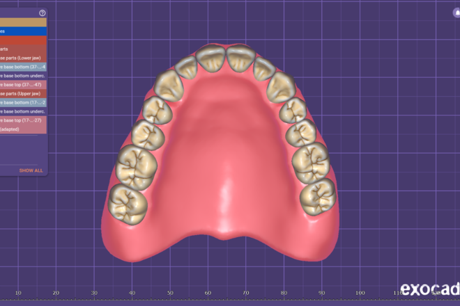 complete denture