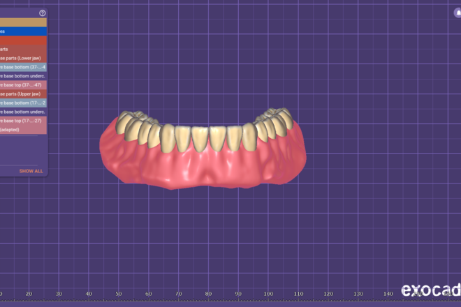 complete denture