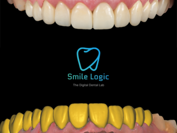 Dental Cad-Service: crowns / bridge/inlay /full arches