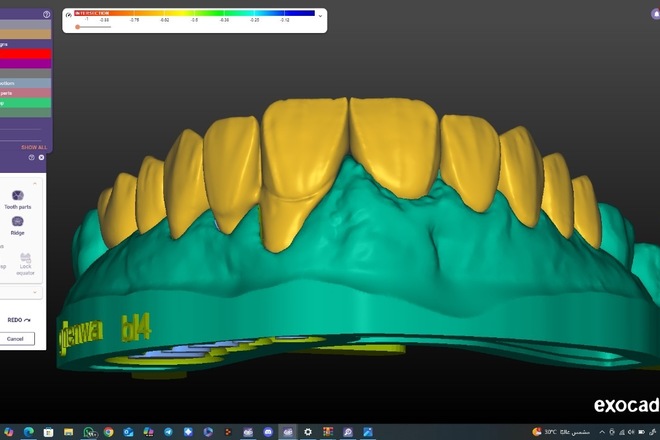 Professional Exocad Dental Designer