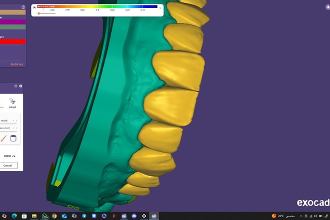 Professional Exocad Dental Designer