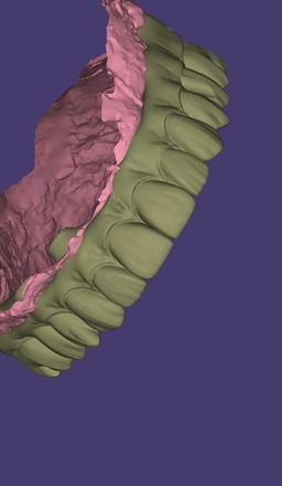 Professional Exocad Dental Designer