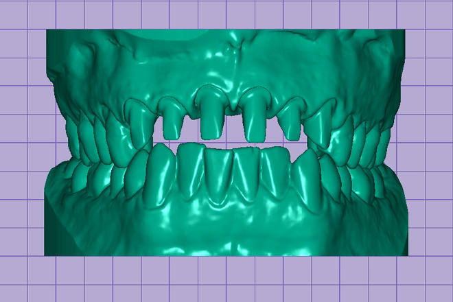 Dental model for 3d printing - CadCam Masters