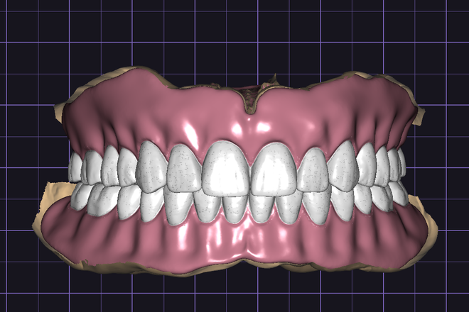 FULL DENTURE