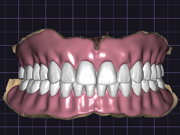 Dental Cad Service: FULL DENTURE