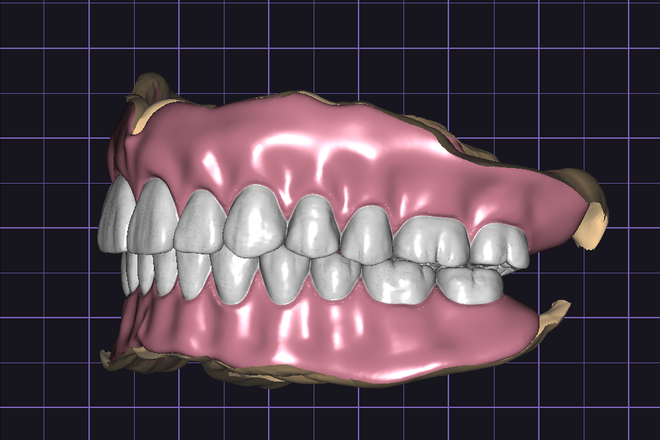 FULL DENTURE