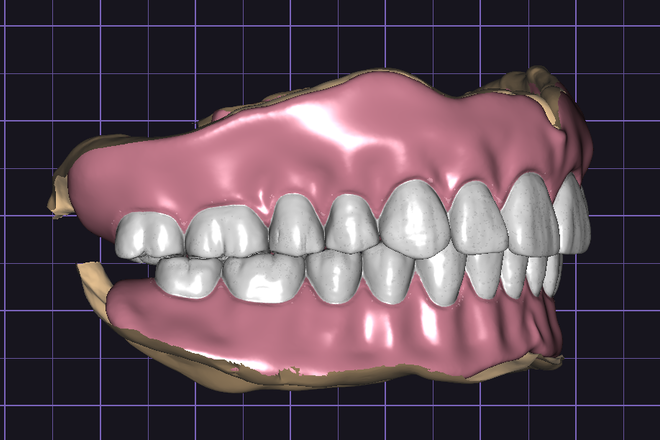 FULL DENTURE