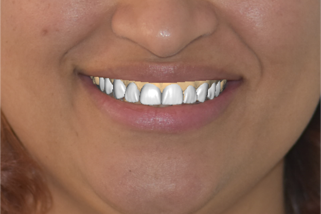 Digital Smile Design
