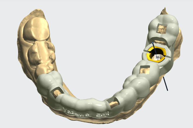 SURGICAL GUIDE