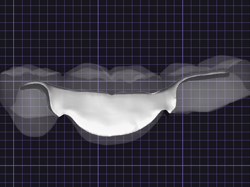 Servicio de Cad Dental: Design Crown Brigde combine Bar, Best solution for Long Bridge !!