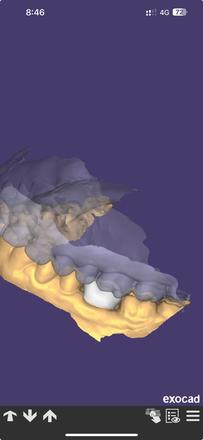 Crown and Bridge Design - CadCam Masters