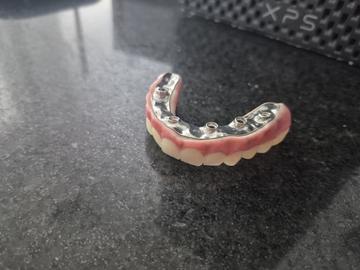Servicio de Cad Dental: Premium Upper Prosthetic Protocol with iBar