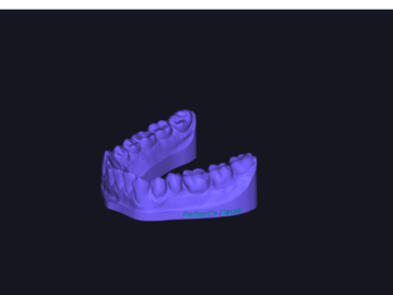 Servicio de Cad Dental: 3D Model Ready for Printing