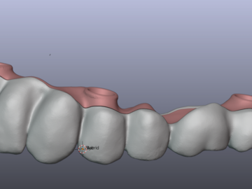 Servicio de Cad Dental: Implant Bars