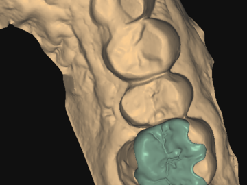 Dental Cad-Service: on
