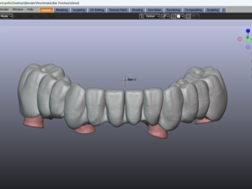 Dental Cad-Service: Full Arch over Implants - All-on-X Framework Design