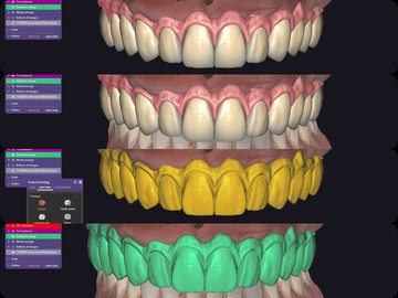 Serviço de Cad Dental: Receive the case as soon as possible