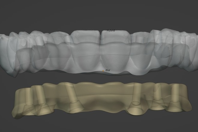 IBAR DISIGN BLENDER FOR DENTAL