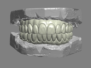 Serviço de Cad Dental: Dental Cad/Cam designer low price