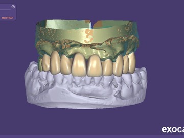 Serviço de Cad Dental: Fuentes fijos