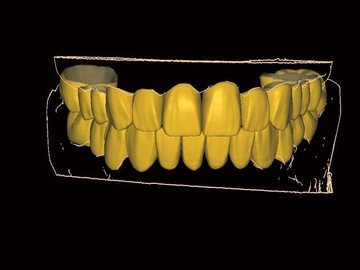 Serviço de Cad Dental: Design 