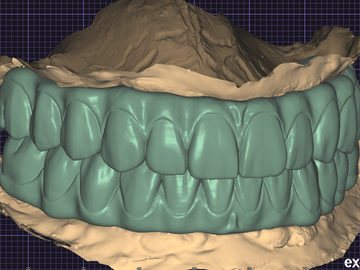 Serviço de Cad Dental: Full Arch : All on X