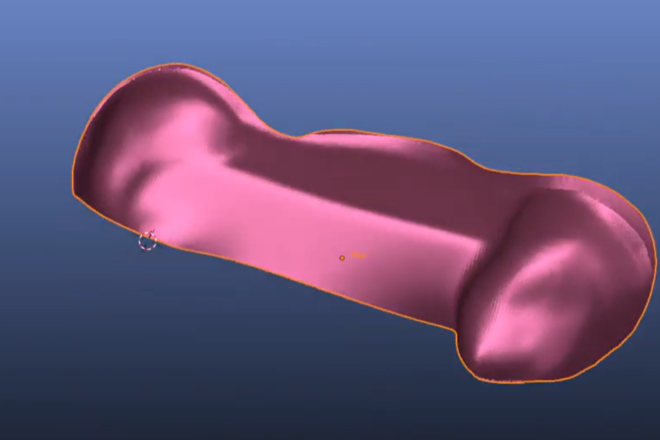 splitting bridges into bar and shell (implant or tooth supported)