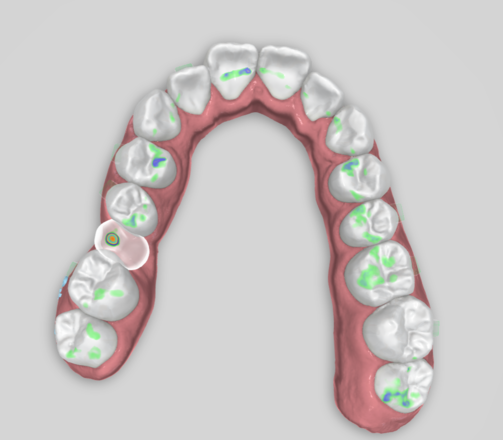  Digital Orthodontic Planning/Planejamento Ortodôntico Digital