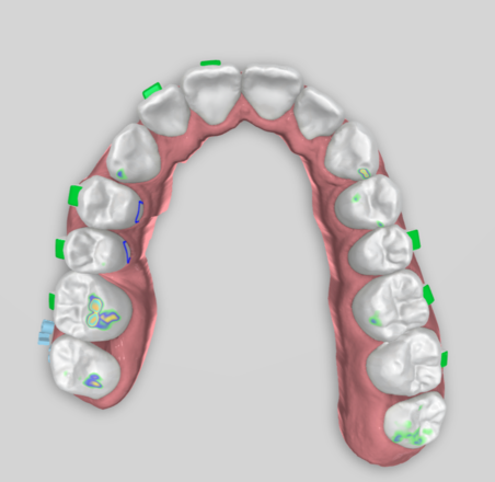  Digital Orthodontic Planning/Planejamento Ortodôntico Digital