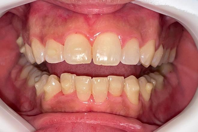  Digital Orthodontic Planning/Planejamento Ortodôntico Digital