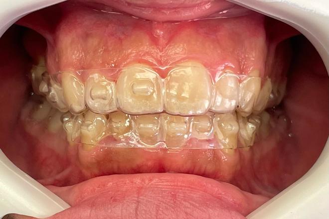 Digital Orthodontic Planning/Planejamento Ortodôntico Digital