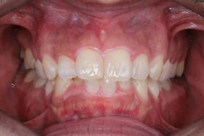  Digital Orthodontic Planning/Planejamento Ortodôntico Digital