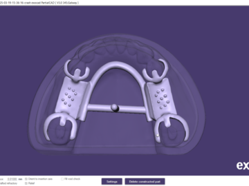 Dental Cad Service: Metal framework for partial denture