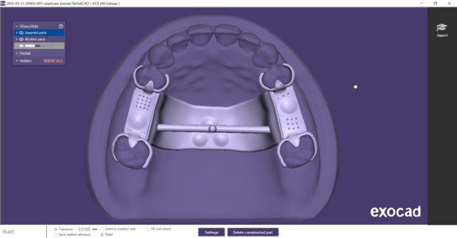 Metal framework for partial denture