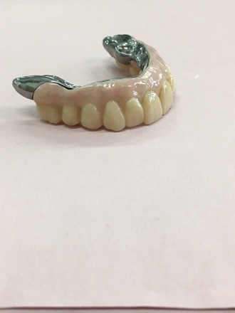 Implant Bar with All on X on it