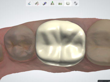 Service de Cad Dentaire: Premium Quality Fixed Restorations