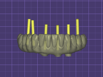 Dental Cad Service: All on X Full Arch Design