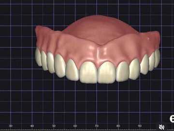 Dental Cad-Service: protese total