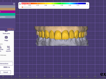 Dental Cad Service: Digital Waxup - Mockup 